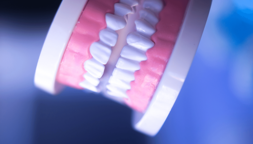 4 cara menghilangkan plak pada gigi