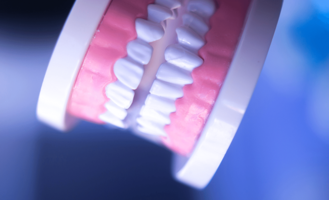 4 cara menghilangkan plak pada gigi