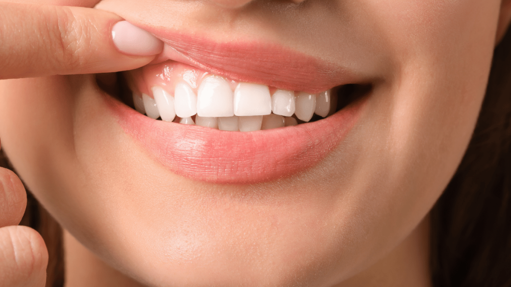 Mengapa Gusi Menjadi Bengkak