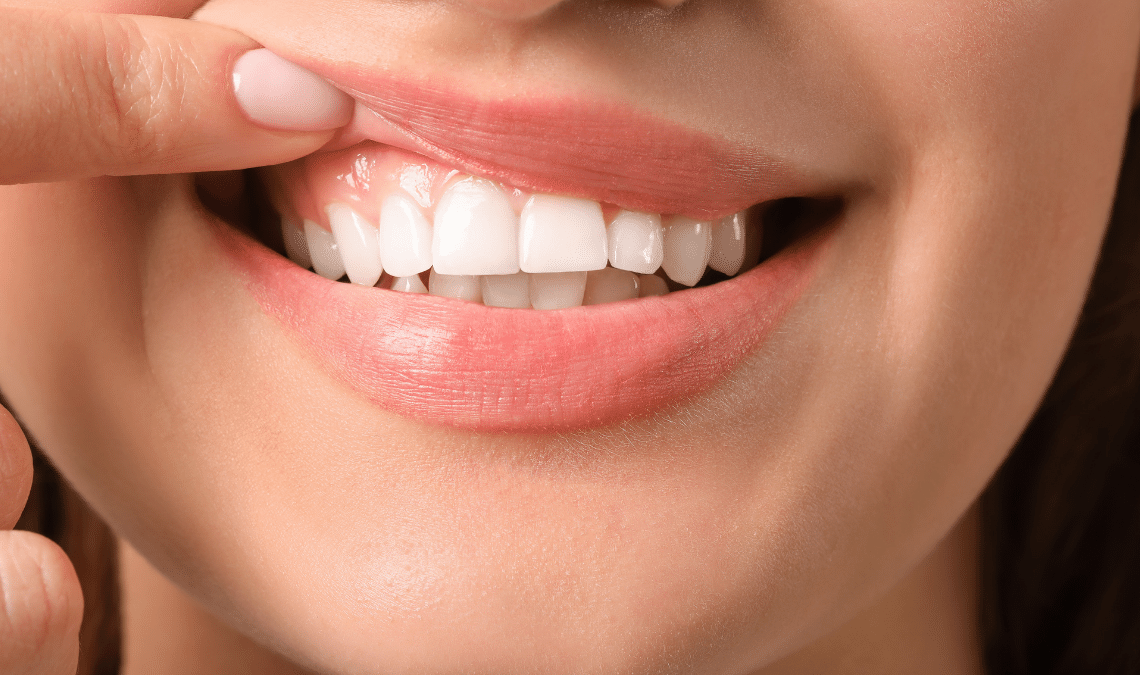 Mengapa Gusi Menjadi Bengkak